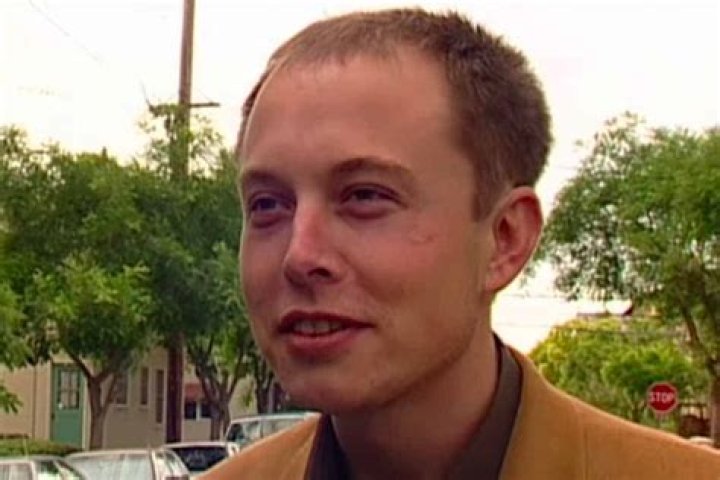 Unveiling The Secrets Of Elon Musk's Balding: Insights And Discoveries